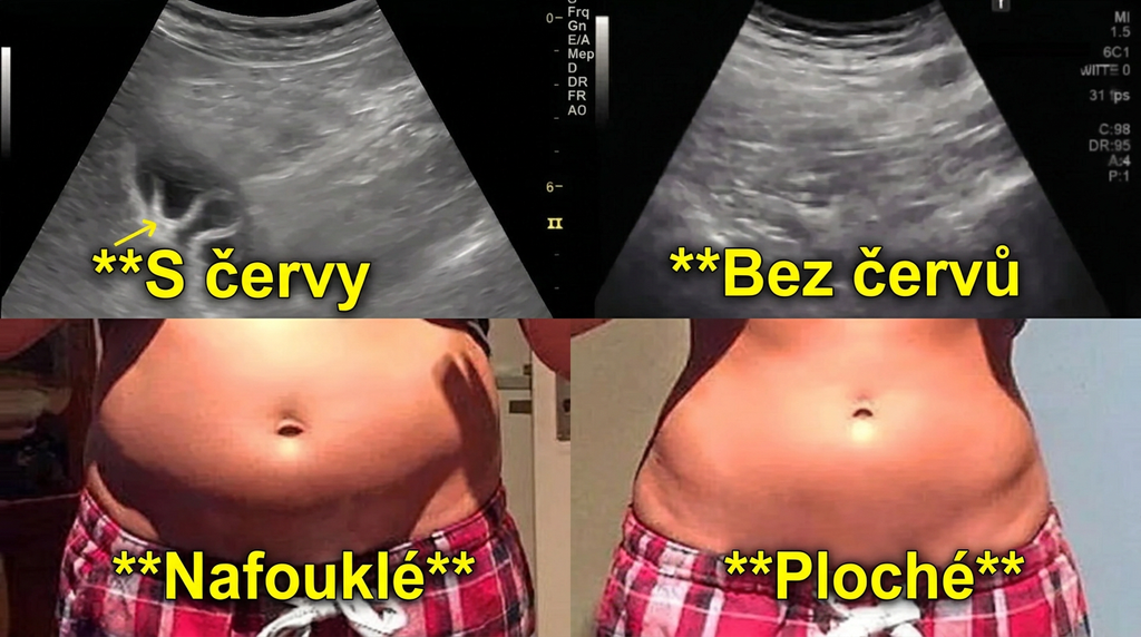 Belviat – srovnání před/po